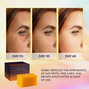 KOJIC ACID DARK SPOT REMOVER